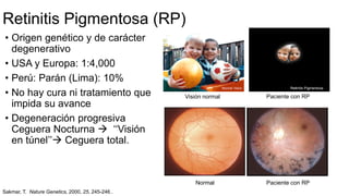 • Origen genético y de carácter
degenerativo
• USA y Europa: 1:4,000
• Perú: Parán (Lima): 10%
• No hay cura ni tratamiento que
impida su avance
• Degeneración progresiva
Ceguera Nocturna  ‘‘Visión
en túnel’’ Ceguera total.
Visión normal Paciente con RP
Normal Paciente con RP
Retinitis Pigmentosa (RP)
Sakmar, T. Nature Genetics, 2000, 25, 245-246 .
 