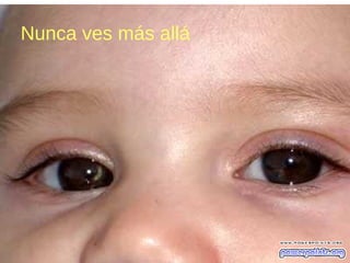 Nunca ves más allá
 