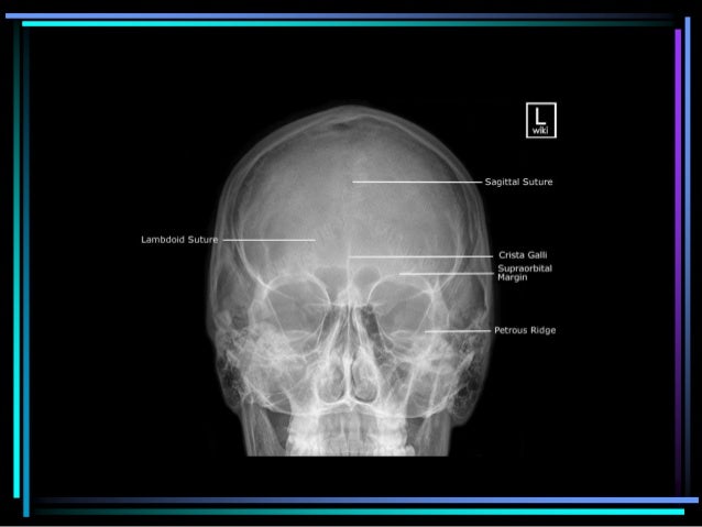 Roentgenology of skull