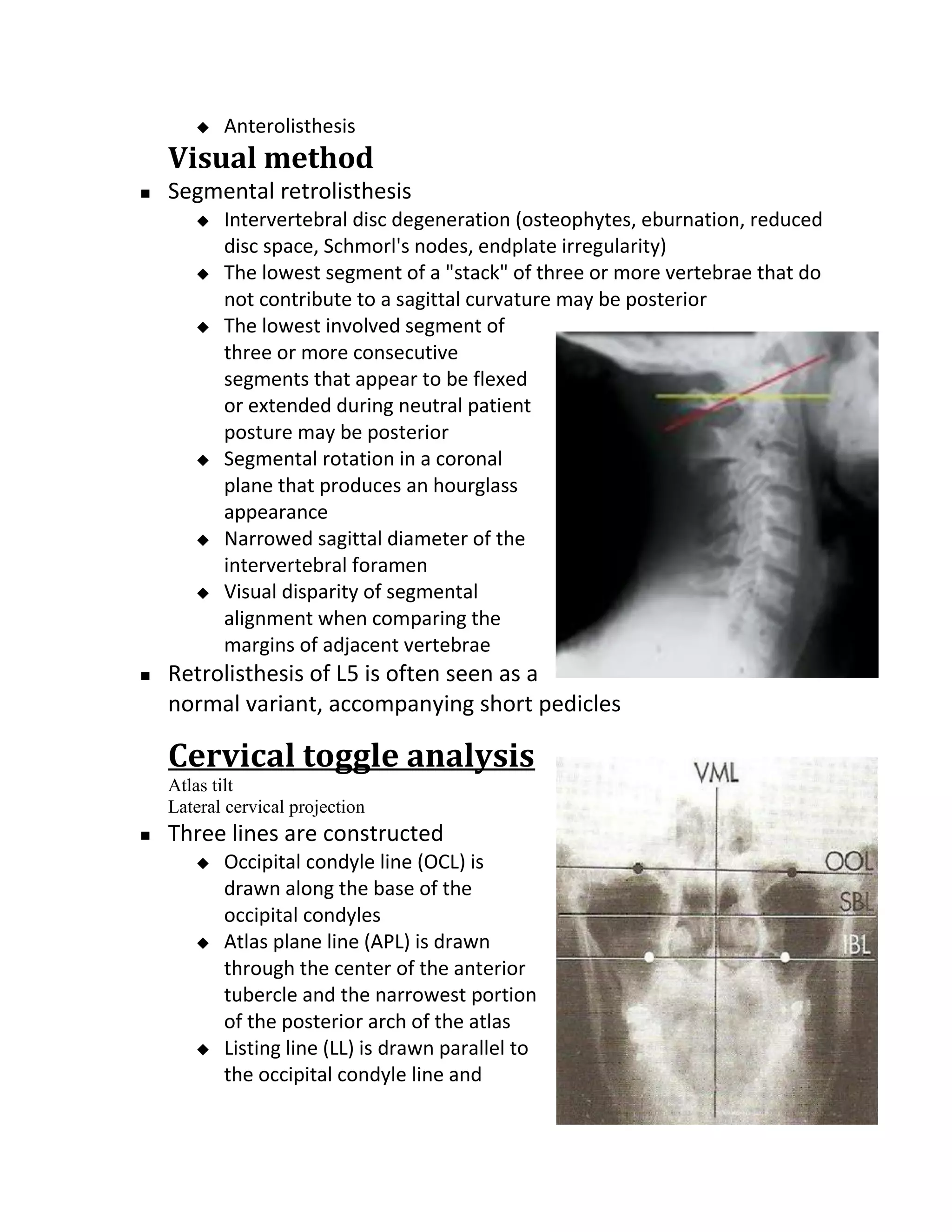   Anterolisthesis
    Visual method
   Segmental retrolisthesis
          Intervertebral disc degeneration (osteophytes, eburnation, reduced
           disc space, Schmorl's nodes, endplate irregularity)
          The lowest segment of a "stack" of three or more vertebrae that do
           not contribute to a sagittal curvature may be posterior
          The lowest involved segment of
           three or more consecutive
           segments that appear to be flexed
           or extended during neutral patient
           posture may be posterior
          Segmental rotation in a coronal
           plane that produces an hourglass
           appearance
          Narrowed sagittal diameter of the
           intervertebral foramen
          Visual disparity of segmental
           alignment when comparing the
           margins of adjacent vertebrae
   Retrolisthesis of L5 is often seen as a
    normal variant, accompanying short pedicles

    Cervical toggle analysis
    Atlas tilt
    Lateral cervical projection
   Three lines are constructed
          Occipital condyle line (OCL) is
           drawn along the base of the
           occipital condyles
          Atlas plane line (APL) is drawn
           through the center of the anterior
           tubercle and the narrowest portion
           of the posterior arch of the atlas
          Listing line (LL) is drawn parallel to
           the occipital condyle line and
 