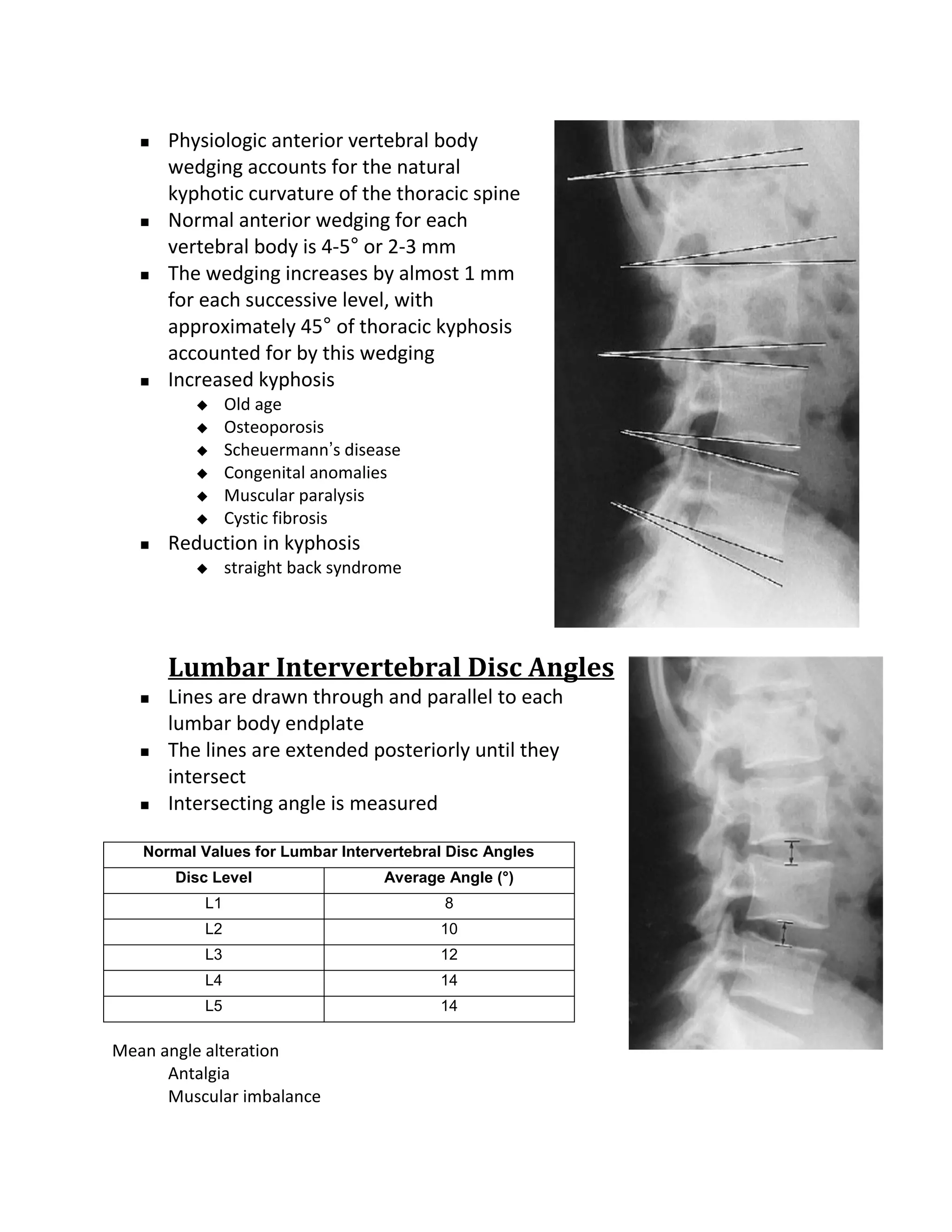    Physiologic anterior vertebral body
       wedging accounts for the natural
       kyphotic curvature of the thoracic spine
      Normal anterior wedging for each
       vertebral body is 4-5° or 2-3 mm
      The wedging increases by almost 1 mm
       for each successive level, with
       approximately 45° of thoracic kyphosis
       accounted for by this wedging
      Increased kyphosis
               Old age
               Osteoporosis
               Scheuermann’s disease
               Congenital anomalies
               Muscular paralysis
               Cystic fibrosis
      Reduction in kyphosis
               straight back syndrome




       Lumbar Intervertebral Disc Angles
      Lines are drawn through and parallel to each
       lumbar body endplate
      The lines are extended posteriorly until they
       intersect
      Intersecting angle is measured

   Normal Values for Lumbar Intervertebral Disc Angles
       Disc Level                  Average Angle (°)
           L1                             8
           L2                             10
           L3                             12
           L4                             14
           L5                             14

Mean angle alteration
      Antalgia
      Muscular imbalance
 