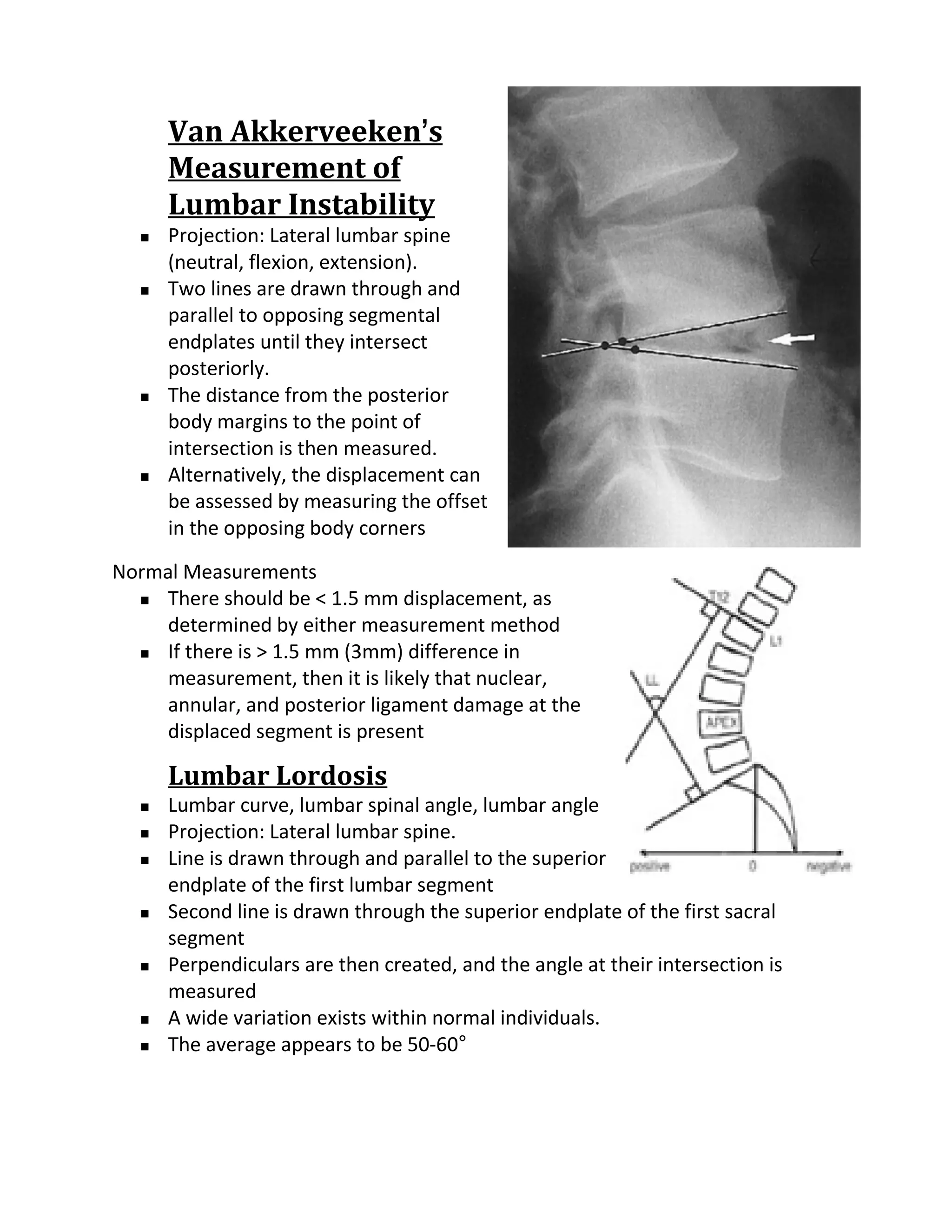 Van Akkerveeken’s
      Measurement of
      Lumbar Instability
     Projection: Lateral lumbar spine
      (neutral, flexion, extension).
     Two lines are drawn through and
      parallel to opposing segmental
      endplates until they intersect
      posteriorly.
     The distance from the posterior
      body margins to the point of
      intersection is then measured.
     Alternatively, the displacement can
      be assessed by measuring the offset
      in the opposing body corners

Normal Measurements
   There should be < 1.5 mm displacement, as

     determined by either measurement method
   If there is > 1.5 mm (3mm) difference in

     measurement, then it is likely that nuclear,
     annular, and posterior ligament damage at the
     displaced segment is present

      Lumbar Lordosis
     Lumbar curve, lumbar spinal angle, lumbar angle
     Projection: Lateral lumbar spine.
     Line is drawn through and parallel to the superior
      endplate of the first lumbar segment
     Second line is drawn through the superior endplate of the first sacral
      segment
     Perpendiculars are then created, and the angle at their intersection is
      measured
     A wide variation exists within normal individuals.
     The average appears to be 50-60°
 