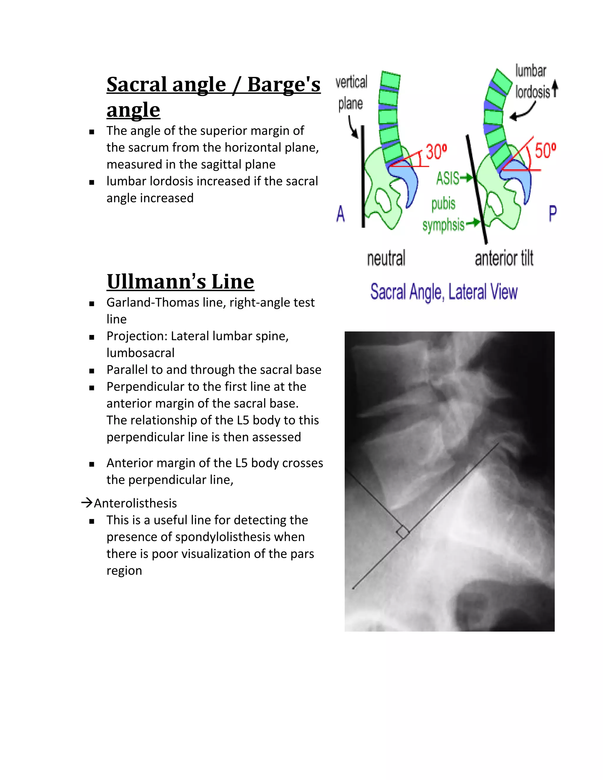 Sacral angle / Barge's
     angle
    The angle of the superior margin of
     the sacrum from the horizontal plane,
     measured in the sagittal plane
    lumbar lordosis increased if the sacral
     angle increased




     Ullmann’s Line
    Garland-Thomas line, right-angle test
     line
    Projection: Lateral lumbar spine,
     lumbosacral
    Parallel to and through the sacral base
    Perpendicular to the first line at the
     anterior margin of the sacral base.
     The relationship of the L5 body to this
     perpendicular line is then assessed
    Anterior margin of the L5 body crosses
     the perpendicular line,
Anterolisthesis
  This is a useful line for detecting the

   presence of spondylolisthesis when
   there is poor visualization of the pars
   region
 