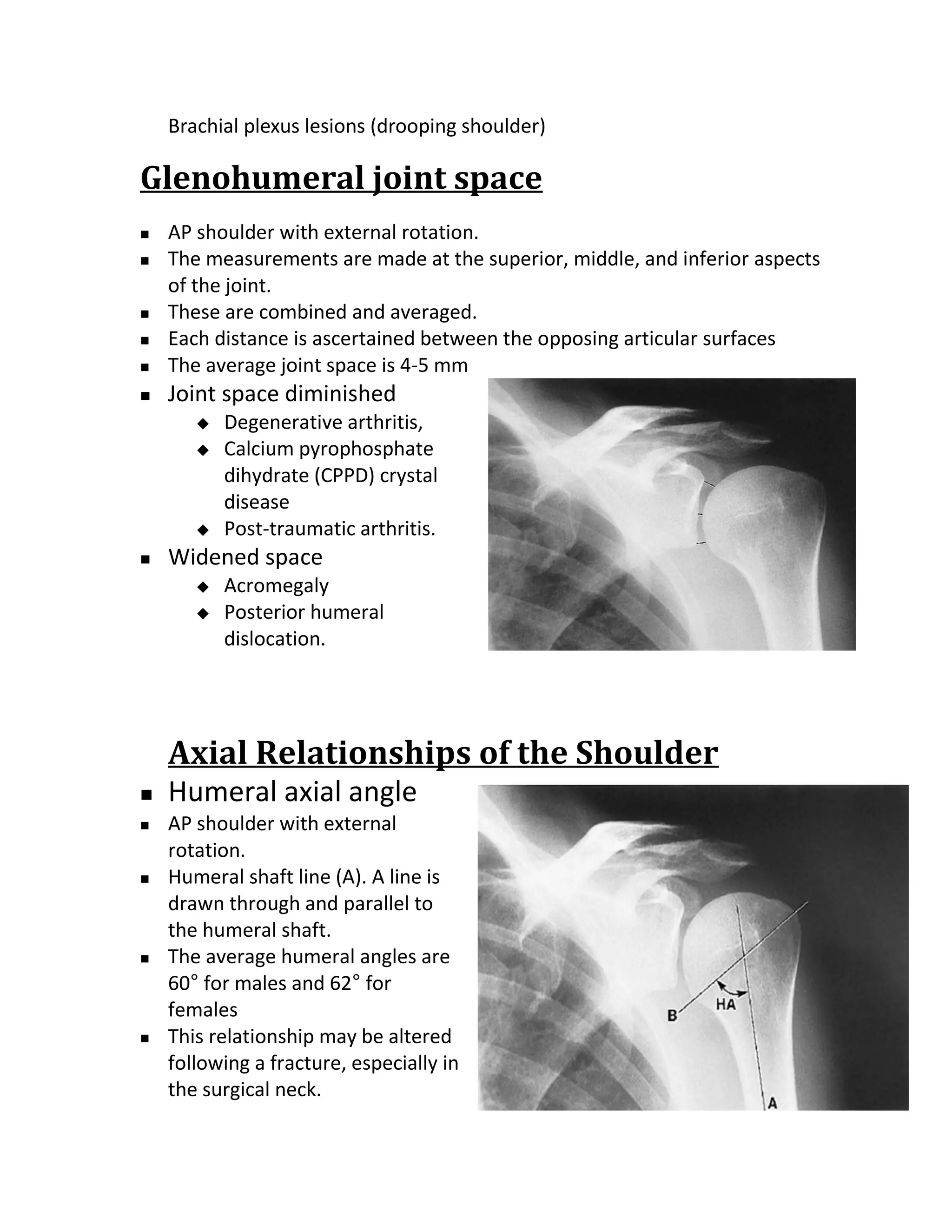 Brachial plexus lesions (drooping shoulder)

Glenohumeral joint space
   AP shoulder with external rotation.
   The measurements are made at the superior, middle, and inferior aspects
    of the joint.
   These are combined and averaged.
   Each distance is ascertained between the opposing articular surfaces
   The average joint space is 4-5 mm
   Joint space diminished
          Degenerative arthritis,
          Calcium pyrophosphate
           dihydrate (CPPD) crystal
           disease
          Post-traumatic arthritis.
   Widened space
          Acromegaly
          Posterior humeral
           dislocation.




    Axial Relationships of the Shoulder
   Humeral axial angle
   AP shoulder with external
    rotation.
   Humeral shaft line (A). A line is
    drawn through and parallel to
    the humeral shaft.
   The average humeral angles are
    60° for males and 62° for
    females
   This relationship may be altered
    following a fracture, especially in
    the surgical neck.
 