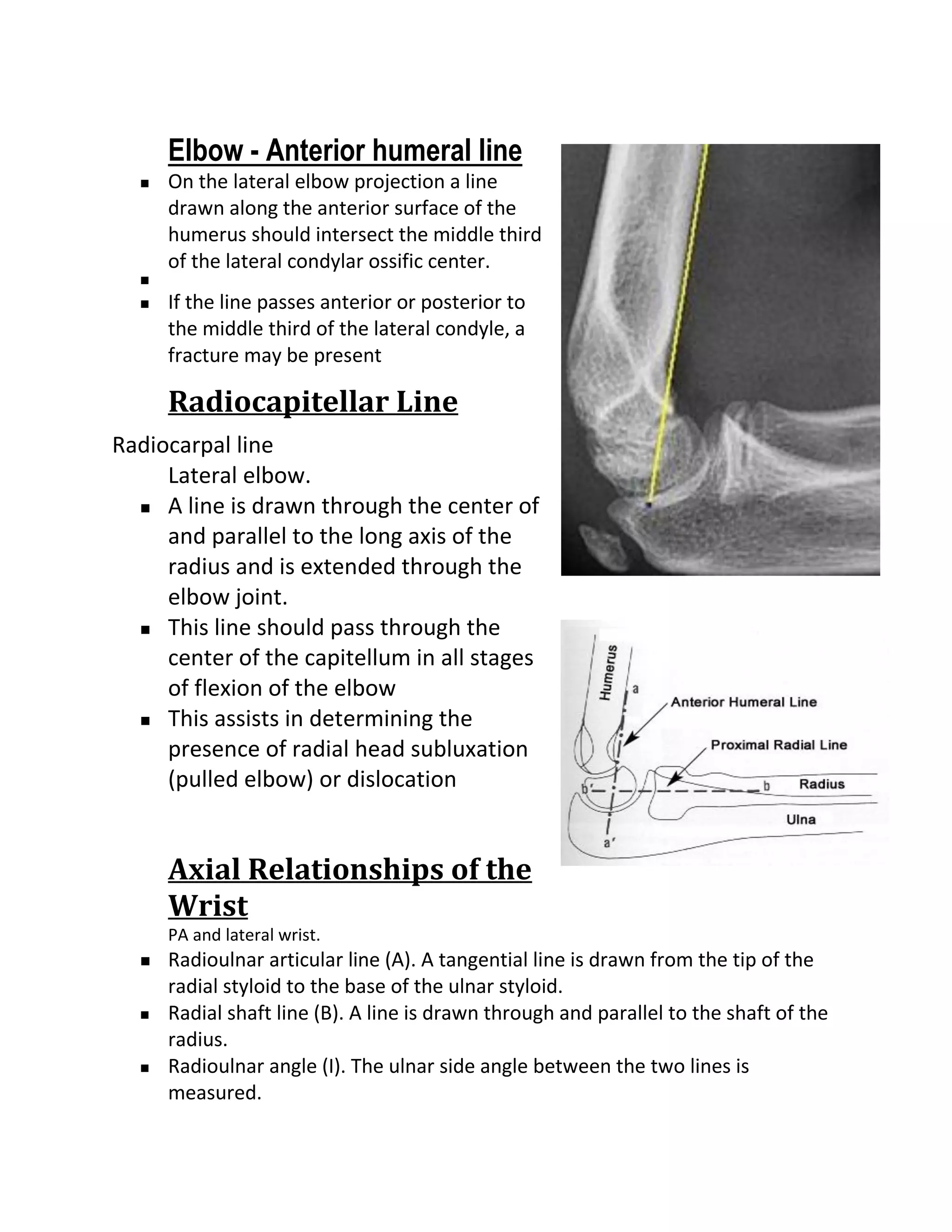 Elbow - Anterior humeral line
     On the lateral elbow projection a line
      drawn along the anterior surface of the
      humerus should intersect the middle third
      of the lateral condylar ossific center.
  
     If the line passes anterior or posterior to
      the middle third of the lateral condyle, a
      fracture may be present

      Radiocapitellar Line
Radiocarpal line
     Lateral elbow.
   A line is drawn through the center of

     and parallel to the long axis of the
     radius and is extended through the
     elbow joint.
   This line should pass through the

     center of the capitellum in all stages
     of flexion of the elbow
   This assists in determining the

     presence of radial head subluxation
     (pulled elbow) or dislocation


      Axial Relationships of the
      Wrist
      PA and lateral wrist.
     Radioulnar articular line (A). A tangential line is drawn from the tip of the
      radial styloid to the base of the ulnar styloid.
     Radial shaft line (B). A line is drawn through and parallel to the shaft of the
      radius.
     Radioulnar angle (I). The ulnar side angle between the two lines is
      measured.
 