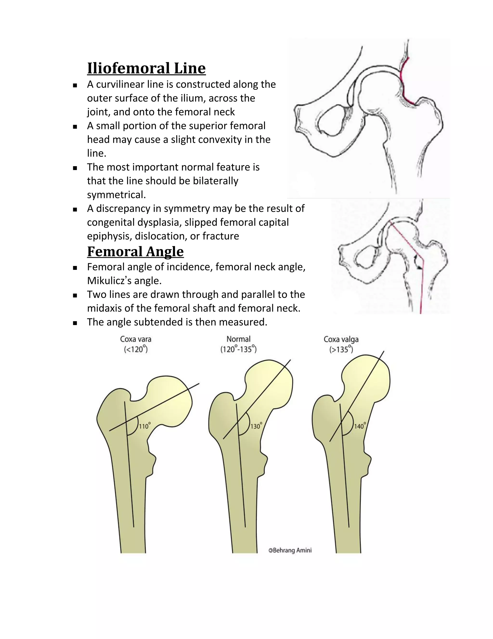 Iliofemoral Line
   A curvilinear line is constructed along the
    outer surface of the ilium, across the
    joint, and onto the femoral neck
   A small portion of the superior femoral
    head may cause a slight convexity in the
    line.
   The most important normal feature is
    that the line should be bilaterally
    symmetrical.
   A discrepancy in symmetry may be the result of
    congenital dysplasia, slipped femoral capital
    epiphysis, dislocation, or fracture
    Femoral Angle
   Femoral angle of incidence, femoral neck angle,
    Mikulicz’s angle.
   Two lines are drawn through and parallel to the
    midaxis of the femoral shaft and femoral neck.
   The angle subtended is then measured.
 