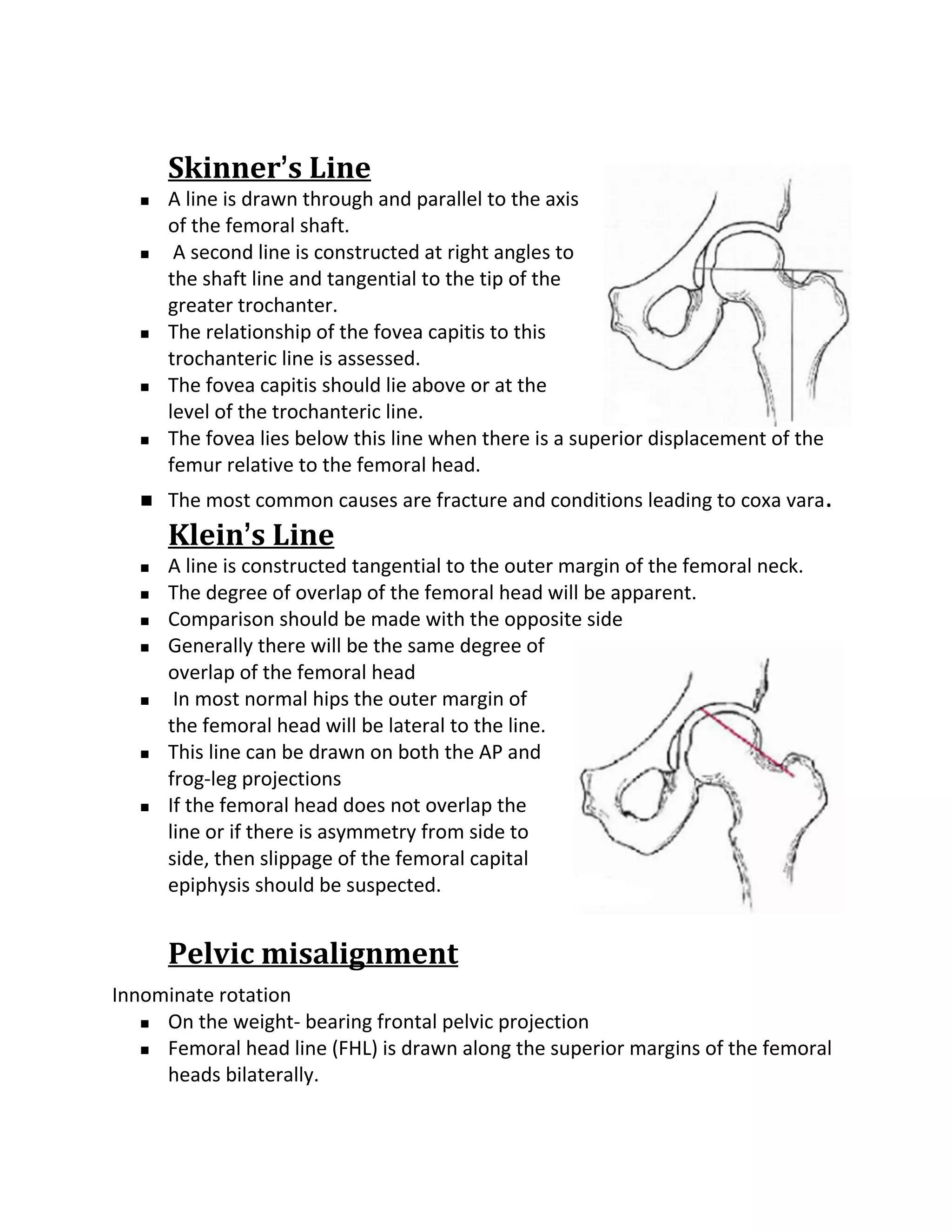 Skinner’s Line
      A line is drawn through and parallel to the axis
       of the femoral shaft.
       A second line is constructed at right angles to
       the shaft line and tangential to the tip of the
       greater trochanter.
      The relationship of the fovea capitis to this
       trochanteric line is assessed.
      The fovea capitis should lie above or at the
       level of the trochanteric line.
      The fovea lies below this line when there is a superior displacement of the
       femur relative to the femoral head.
      The most common causes are fracture and conditions leading to coxa vara.
       Klein’s Line
      A line is constructed tangential to the outer margin of the femoral neck.
      The degree of overlap of the femoral head will be apparent.
      Comparison should be made with the opposite side
      Generally there will be the same degree of
       overlap of the femoral head
       In most normal hips the outer margin of
       the femoral head will be lateral to the line.
      This line can be drawn on both the AP and
       frog-leg projections
      If the femoral head does not overlap the
       line or if there is asymmetry from side to
       side, then slippage of the femoral capital
       epiphysis should be suspected.


       Pelvic misalignment
Innominate rotation
    On the weight- bearing frontal pelvic projection

    Femoral head line (FHL) is drawn along the superior margins of the femoral

     heads bilaterally.
 