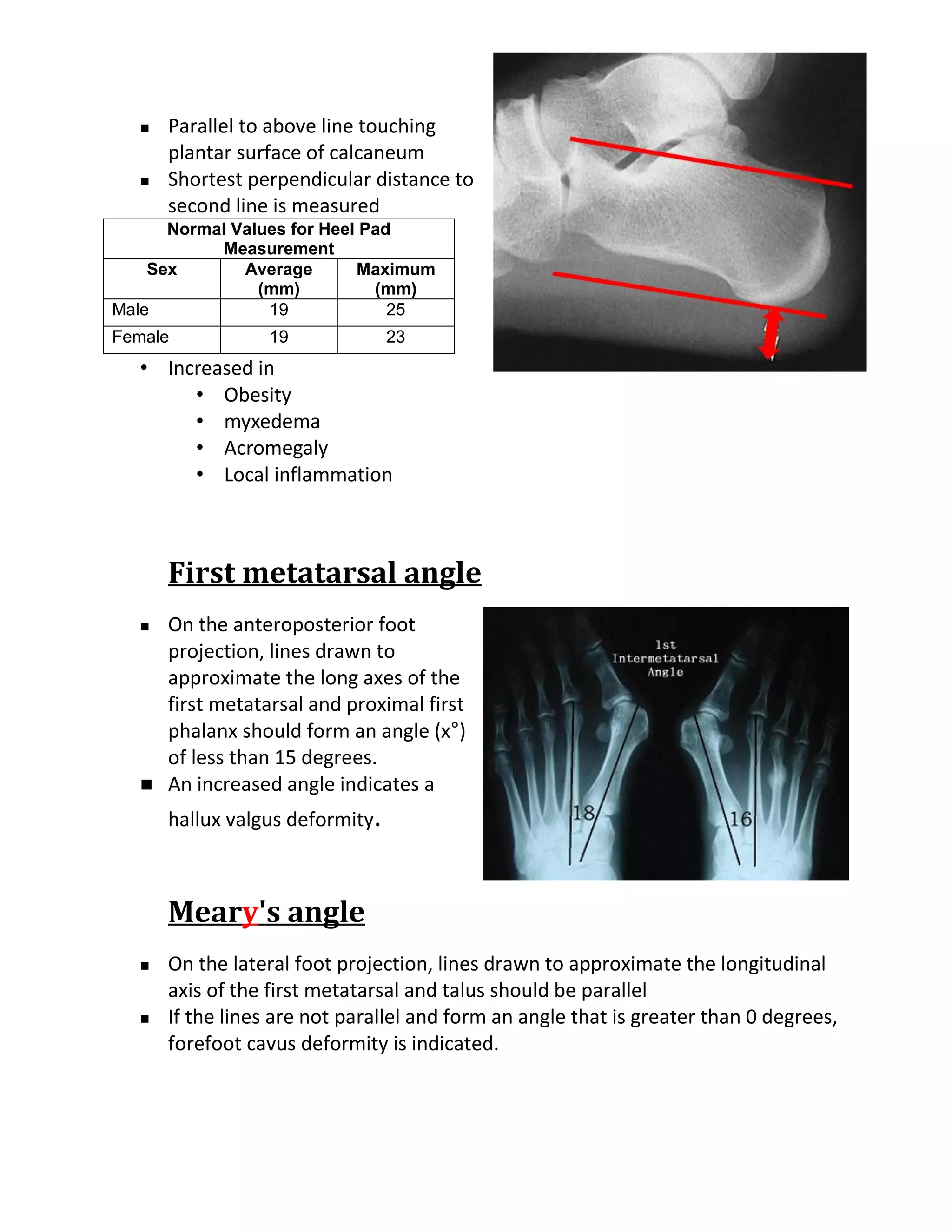    Parallel to above line touching
       plantar surface of calcaneum
      Shortest perpendicular distance to
       second line is measured
      Normal Values for Heel Pad
           Measurement
    Sex       Average       Maximum
                (mm)          (mm)
Male             19             25
Female            19              23
   • Increased in
        • Obesity
        • myxedema
        • Acromegaly
        • Local inflammation



       First metatarsal angle
      On the anteroposterior foot
       projection, lines drawn to
       approximate the long axes of the
       first metatarsal and proximal first
       phalanx should form an angle (x°)
       of less than 15 degrees.
      An increased angle indicates a
       hallux valgus deformity.



       Meary's angle
      On the lateral foot projection, lines drawn to approximate the longitudinal
       axis of the first metatarsal and talus should be parallel
      If the lines are not parallel and form an angle that is greater than 0 degrees,
       forefoot cavus deformity is indicated.
 