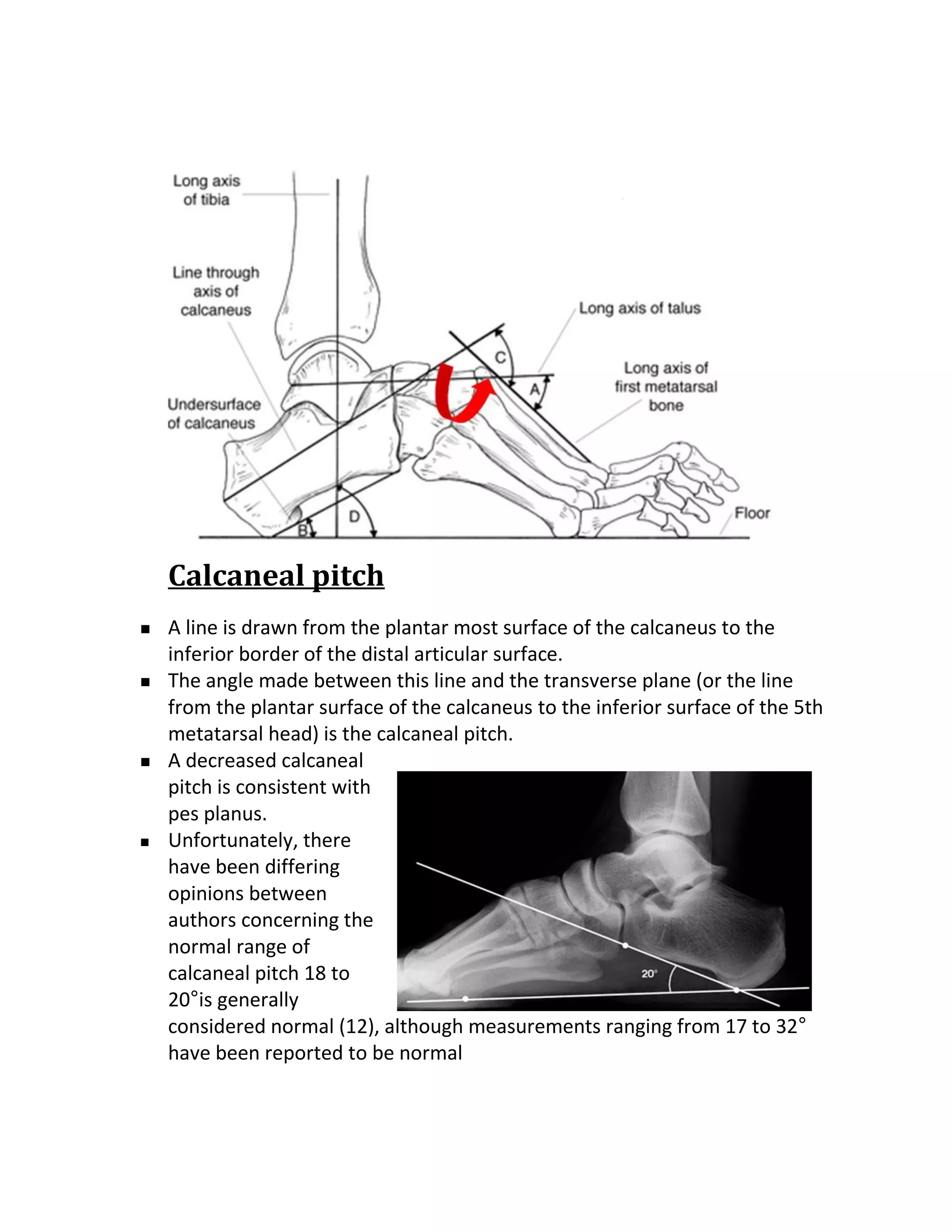 Calcaneal pitch
   A line is drawn from the plantar most surface of the calcaneus to the
    inferior border of the distal articular surface.
   The angle made between this line and the transverse plane (or the line
    from the plantar surface of the calcaneus to the inferior surface of the 5th
    metatarsal head) is the calcaneal pitch.
   A decreased calcaneal
    pitch is consistent with
    pes planus.
   Unfortunately, there
    have been differing
    opinions between
    authors concerning the
    normal range of
    calcaneal pitch 18 to
    20°is generally
    considered normal (12), although measurements ranging from 17 to 32°
    have been reported to be normal
 