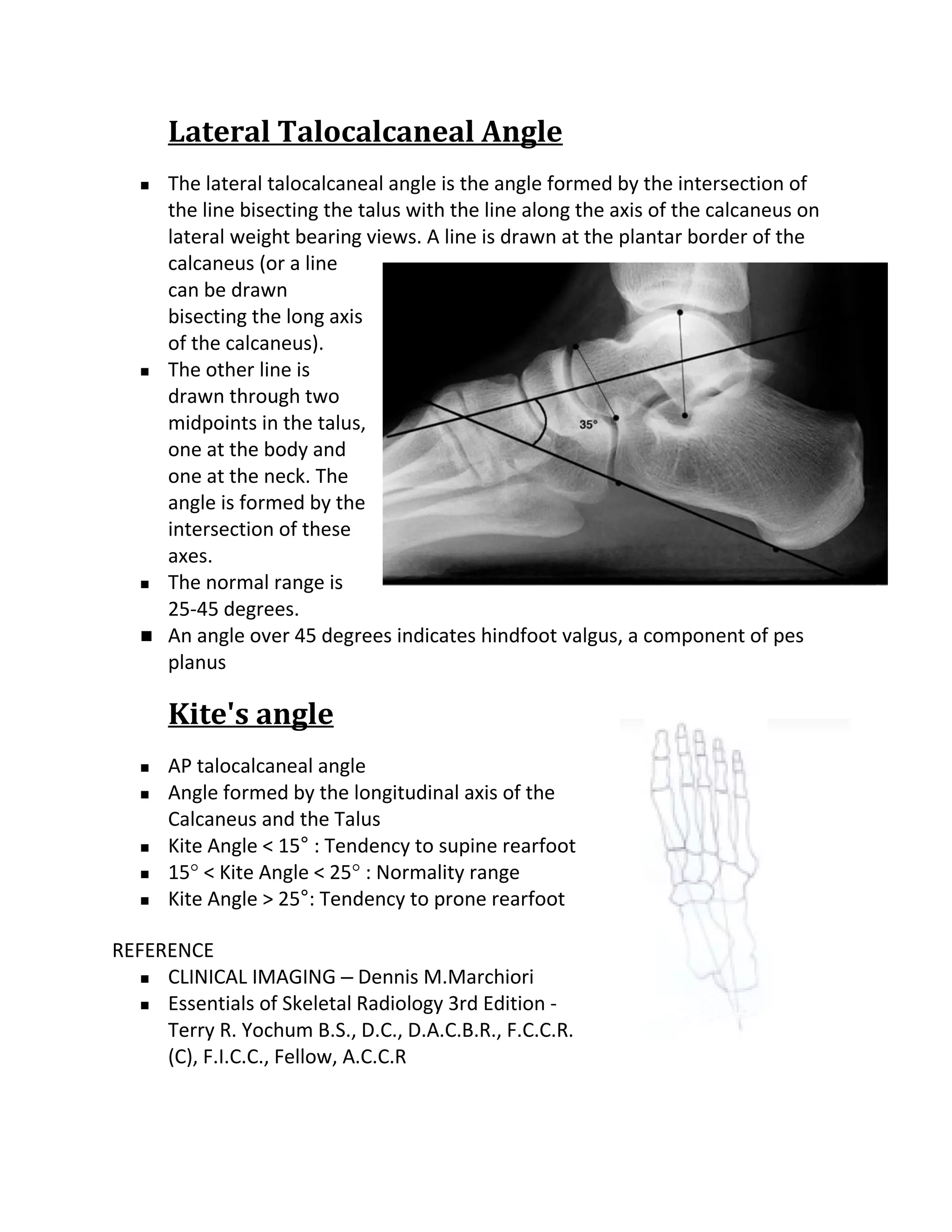 Lateral Talocalcaneal Angle
      The lateral talocalcaneal angle is the angle formed by the intersection of
       the line bisecting the talus with the line along the axis of the calcaneus on
       lateral weight bearing views. A line is drawn at the plantar border of the
       calcaneus (or a line
       can be drawn
       bisecting the long axis
       of the calcaneus).
      The other line is
       drawn through two
       midpoints in the talus,
       one at the body and
       one at the neck. The
       angle is formed by the
       intersection of these
       axes.
      The normal range is
       25-45 degrees.
      An angle over 45 degrees indicates hindfoot valgus, a component of pes
       planus

       Kite's angle
      AP talocalcaneal angle
      Angle formed by the longitudinal axis of the
       Calcaneus and the Talus
      Kite Angle < 15° : Tendency to supine rearfoot
      15° < Kite Angle < 25° : Normality range
      Kite Angle > 25°: Tendency to prone rearfoot

REFERENCE
    CLINICAL IMAGING – Dennis M.Marchiori

    Essentials of Skeletal Radiology 3rd Edition -

     Terry R. Yochum B.S., D.C., D.A.C.B.R., F.C.C.R.
     (C), F.I.C.C., Fellow, A.C.C.R
 