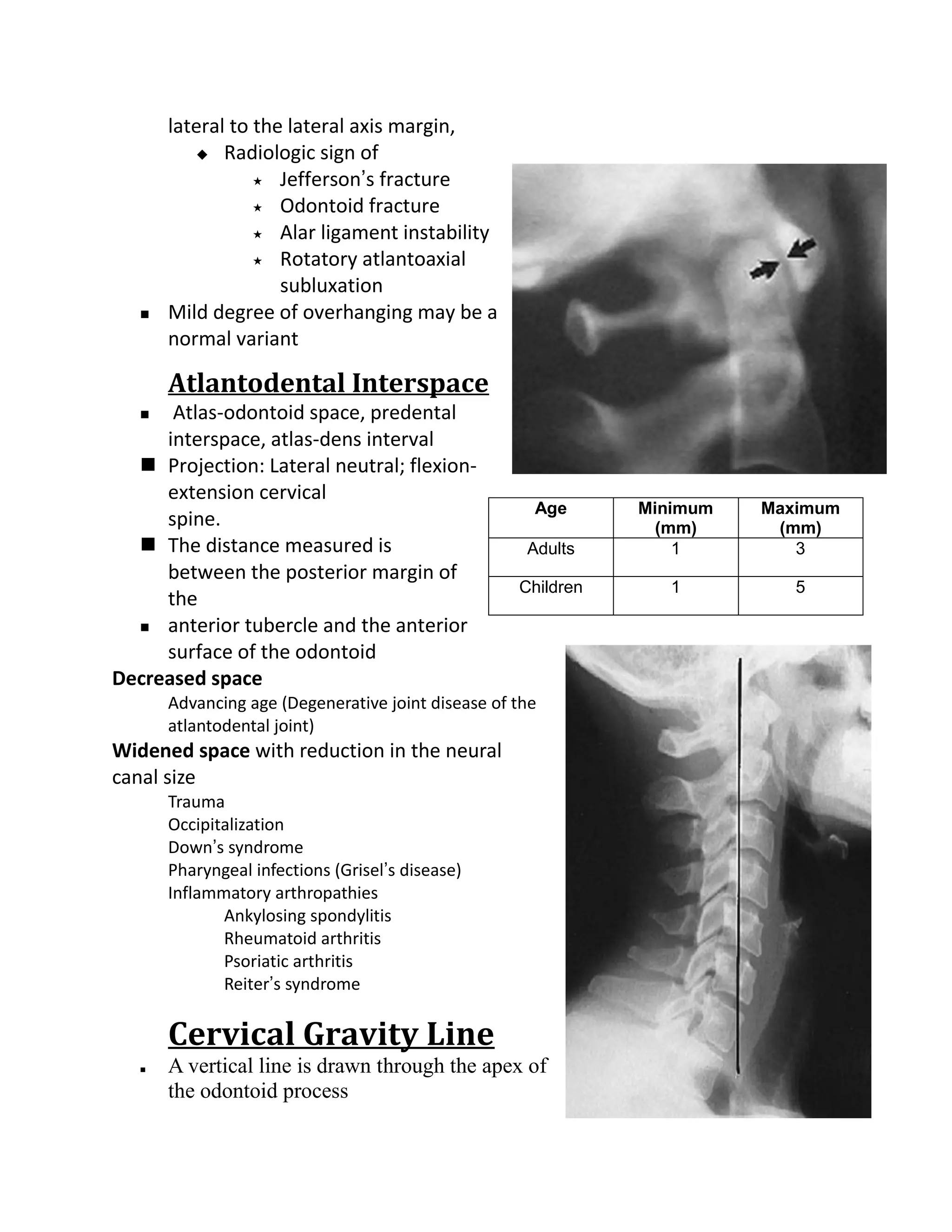 lateral to the lateral axis margin,
           Radiologic sign of

                   Jefferson’s fracture

                   Odontoid fracture

                   Alar ligament instability

                   Rotatory atlantoaxial

                     subluxation
      Mild degree of overhanging may be a
       normal variant

       Atlantodental Interspace
     Atlas-odontoid space, predental
     interspace, atlas-dens interval
   Projection: Lateral neutral; flexion-
     extension cervical
                                                      Age      Minimum   Maximum
     spine.                                                      (mm)     (mm)
   The distance measured is                         Adults        1        3
     between the posterior margin of
                                                    Children      1         5
     the
   anterior tubercle and the anterior

     surface of the odontoid
Decreased space
       Advancing age (Degenerative joint disease of the
       atlantodental joint)
Widened space with reduction in the neural
canal size
       Trauma
       Occipitalization
       Down’s syndrome
       Pharyngeal infections (Grisel’s disease)
       Inflammatory arthropathies
              Ankylosing spondylitis
              Rheumatoid arthritis
              Psoriatic arthritis
              Reiter’s syndrome

       Cervical Gravity Line
      A vertical line is drawn through the apex of
       the odontoid process
 