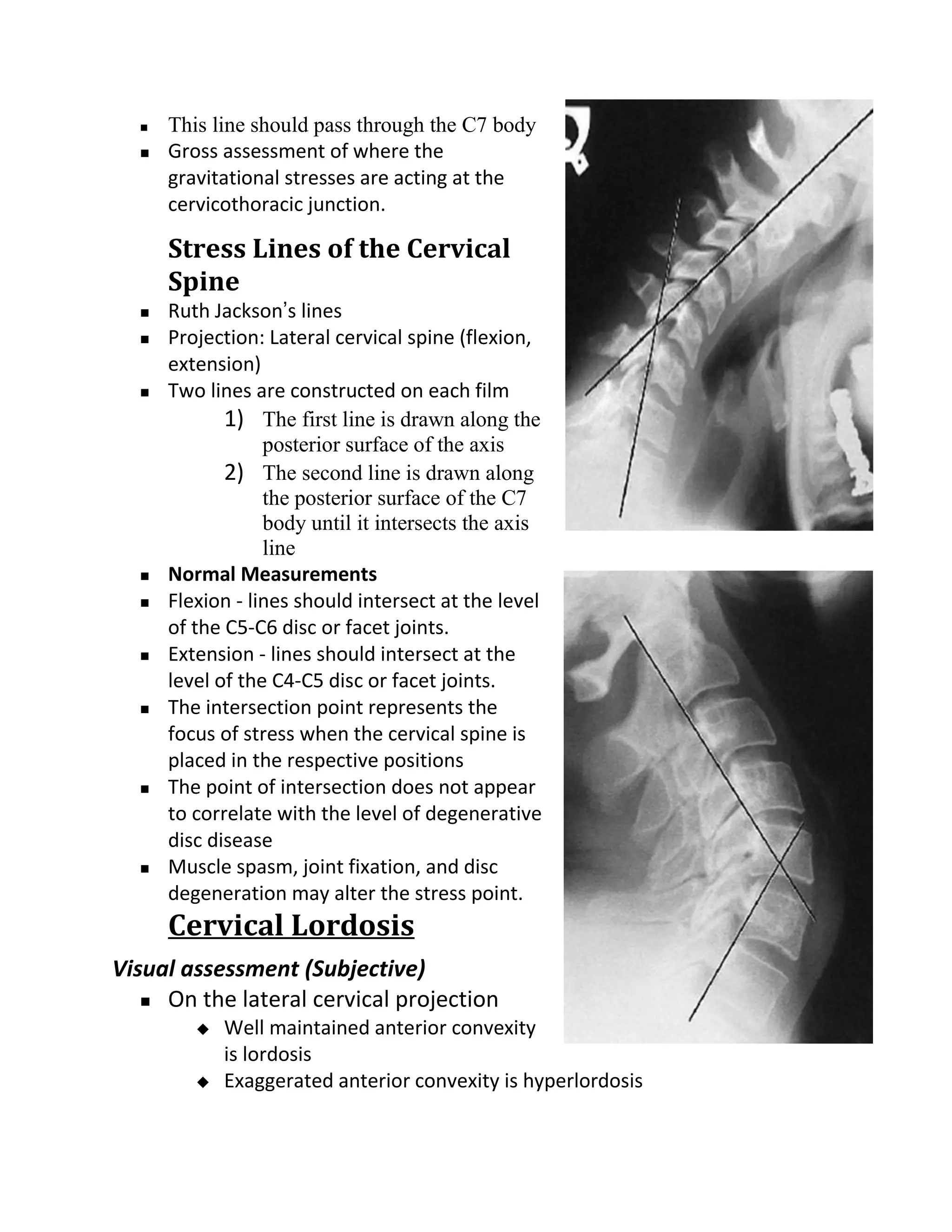    This line should pass through the C7 body
     Gross assessment of where the
      gravitational stresses are acting at the
      cervicothoracic junction.

      Stress Lines of the Cervical
      Spine
     Ruth Jackson’s lines
     Projection: Lateral cervical spine (flexion,
      extension)
     Two lines are constructed on each film
             1) The first line is drawn along the
                  posterior surface of the axis
             2) The second line is drawn along
                  the posterior surface of the C7
                  body until it intersects the axis
                  line
     Normal Measurements
     Flexion - lines should intersect at the level
      of the C5-C6 disc or facet joints.
     Extension - lines should intersect at the
      level of the C4-C5 disc or facet joints.
     The intersection point represents the
      focus of stress when the cervical spine is
      placed in the respective positions
     The point of intersection does not appear
      to correlate with the level of degenerative
      disc disease
     Muscle spasm, joint fixation, and disc
      degeneration may alter the stress point.
      Cervical Lordosis
Visual assessment (Subjective)
    On the lateral cervical projection
            Well maintained anterior convexity
             is lordosis
            Exaggerated anterior convexity is hyperlordosis
 