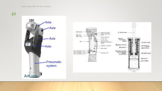 Rohan_Gupta_Control Mechanism of Prosthetic Knee Joints_Assignment.pptx