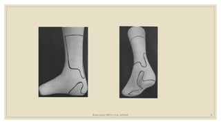 Rohan_Gupta_Orthotic Management of Physioneurological AFO_Assignment.pptx