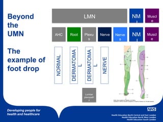 Developing people for
health and healthcare
LMN NM
J
Muscl
e
NM
J
Muscl
e
AHC BrainRoot Plexu
s
Nerve Nerve
s
Beyond
the
UMN
The
example of
foot drop
NORMAL
DERMATOMA
L
DERMATOMA
L
NERVE
Lumbar
plexopath
y
 