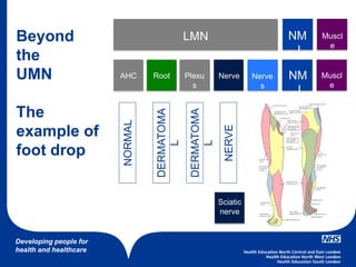 Developing people for
health and healthcare
LMN NM
J
Muscl
e
NM
J
Muscl
e
AHC BrainRoot Plexu
s
Nerve Nerve
s
Beyond
the
UMN
The
example of
foot drop
NORMAL
DERMATOMA
L
DERMATOMA
L
NERVE
Sciatic
nerve
 