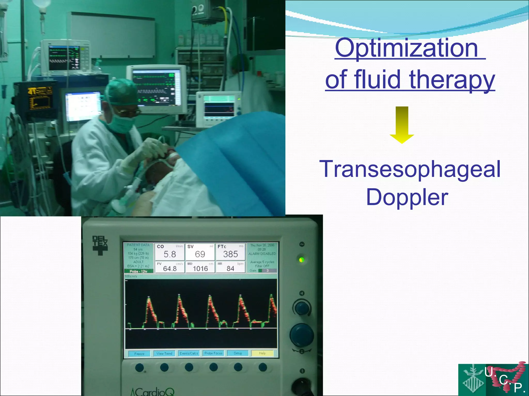 Fluid therapy and colorectal surgery Use or abuse?