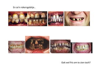 En zo’n rokersgebitje..
Ook wel fris om te zien toch?
 