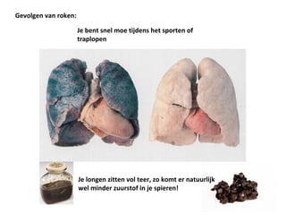 Gevolgen van roken:
Je bent snel moe tijdens het sporten of
traplopen
Je longen zitten vol teer, zo komt er natuurlijk
wel minder zuurstof in je spieren!
 