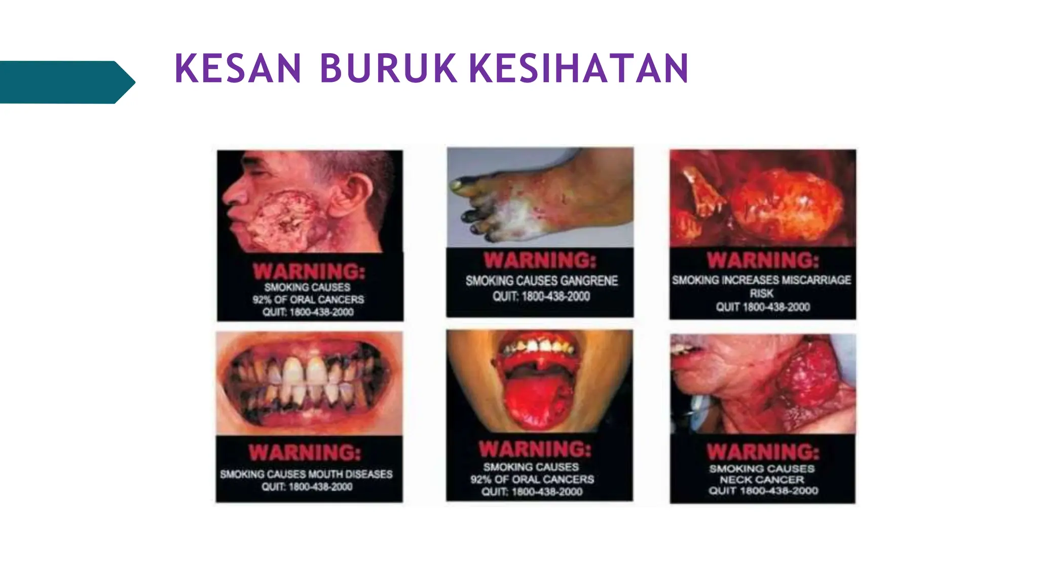 Rokok dan vape | kesan-kesan vape elektronik | PPTX
