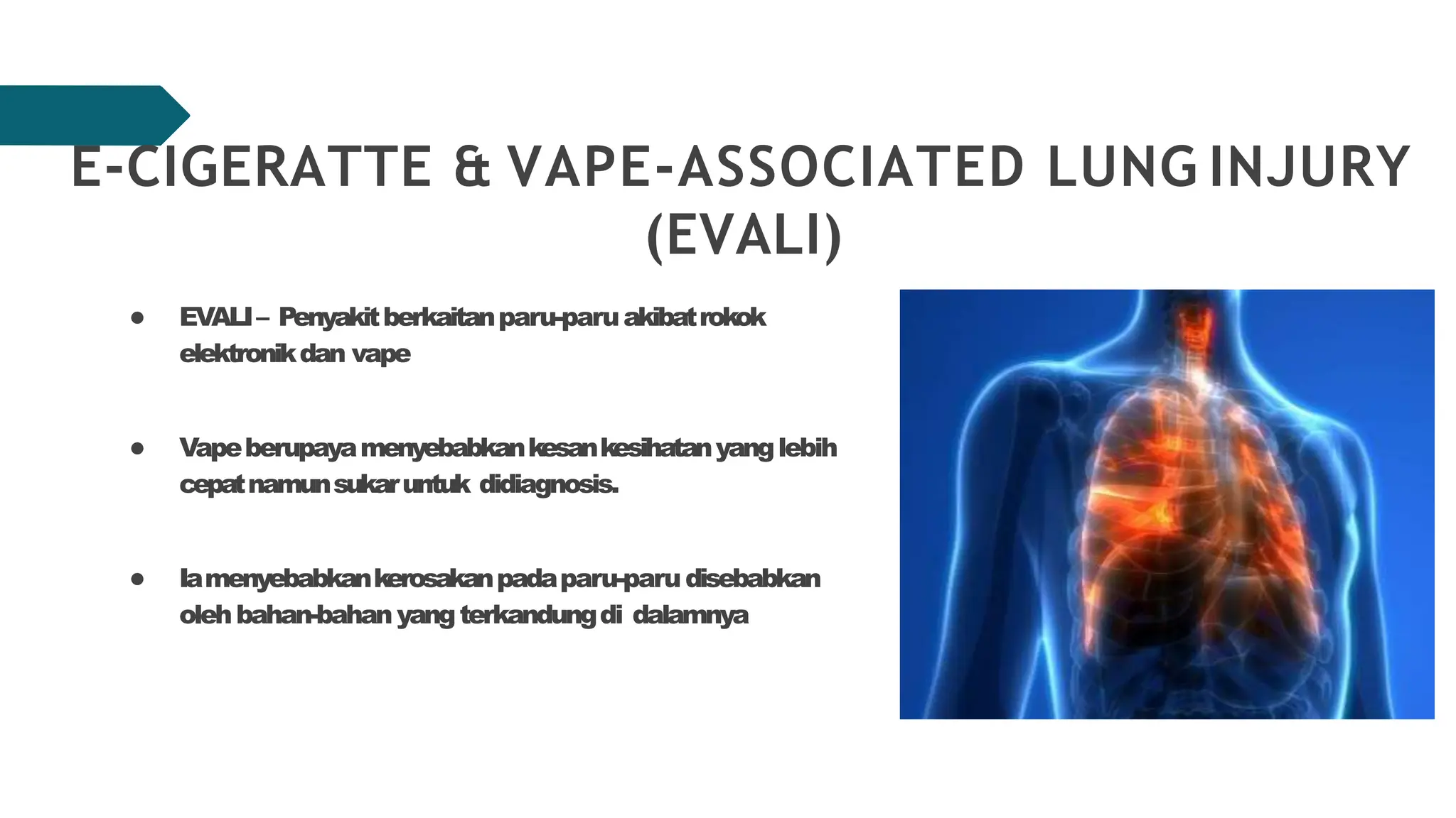 Rokok dan vape | kesan-kesan vape elektronik | PPTX