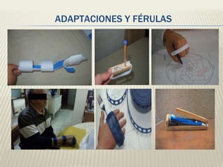 ADAPTACIONES Y FÉRULAS 
 