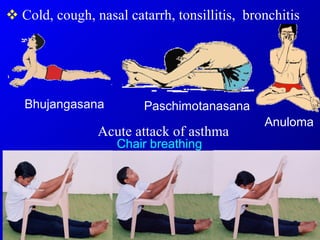 [object Object],Chair breathing Bhujangasana Paschimotanasana Anuloma Acute attack of asthma 