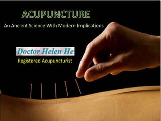 An Ancient Science With Modern Implications
Registered Acupuncturist
 