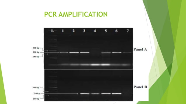 ROLE OF ADD1 GENE IN HYPERTENSIVE PATIENTS.pptx