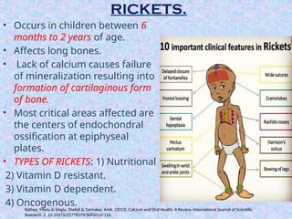 Calcium Rickets Role of Calcium in Bone metabolism & pathologies SEMINAR 2.pptx