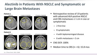 Alectinib in Patients With NSCLC and Symptomatic or
Large Brain Metastases
 Retrospective review of 19 patients
with advanced ALK-positive NSCLC
and CNS metastases ≥ 1 cm in size or
symptomatic
‒ 2 first line
‒ 8 symptomatic
‒ 4 with leptomeningeal disease
‒ 6 with metastases > 2 cm
 CNS DCR: 100%
 Median time to SRS (n = 6): 15.8 mos
Lin. J Thorac Oncol. 2019; 14:683.
Patient 1
Patient 6
 