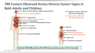 TRK Fusions Observed Across Diverse Cancer Types in
Both Adults and Children
Hyman. ASCO 2017. Abstr LBA2501.
Brain cancers (glioma, GBM, astrocytoma)
Thyroid cancer
Salivary (MASC)
Lung cancer
Secretory breast cancer
Pancreatic
Cholangiocarcinoma
GIST
Colon
Melanoma
Sarcoma (multiple)
Gliomas
Infantile fibrosarcoma
Thyroid cancer
Congenital nephroma
Spitz nevi
Sarcoma (multiple)
Common cancer with low
TRK fusion frequency
Rare cancer with high
TRK fusion frequency
Estimated 1500-5000 patients with NTRK fusion–positive cancers in the US annually
 