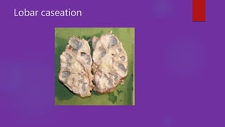 Caseation Hitopath Role of imaging in urosepsis | PPTX