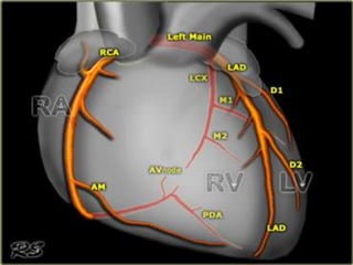 Role of ct angiography in diagnosis of coronary anomalies | PPTX