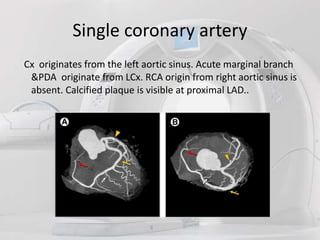 Role of ct angiography in diagnosis of coronary anomalies | PPTX