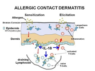Role of cytokines in type iv hypersensitivity | PPTX