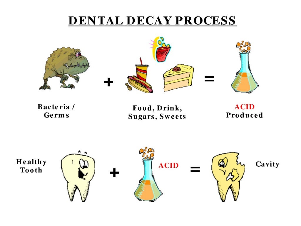 Role of diet and nutrition in dental caries