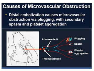 Role of embolic protection device in coronary and carotid intervention ...
