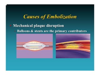 Role of embolic protection device in coronary and carotid intervention ...