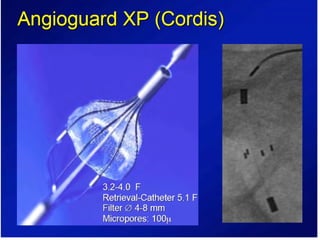 Role of embolic protection device in coronary and carotid intervention ...