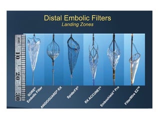Role of embolic protection device in coronary and carotid intervention ...