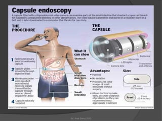 Role of endoscopy in git cancers | PDF