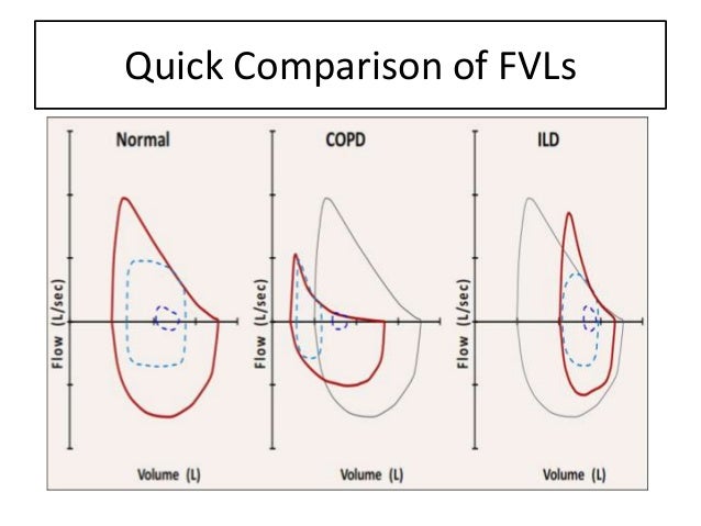 role of flow volume loops in cpet flow volume loop