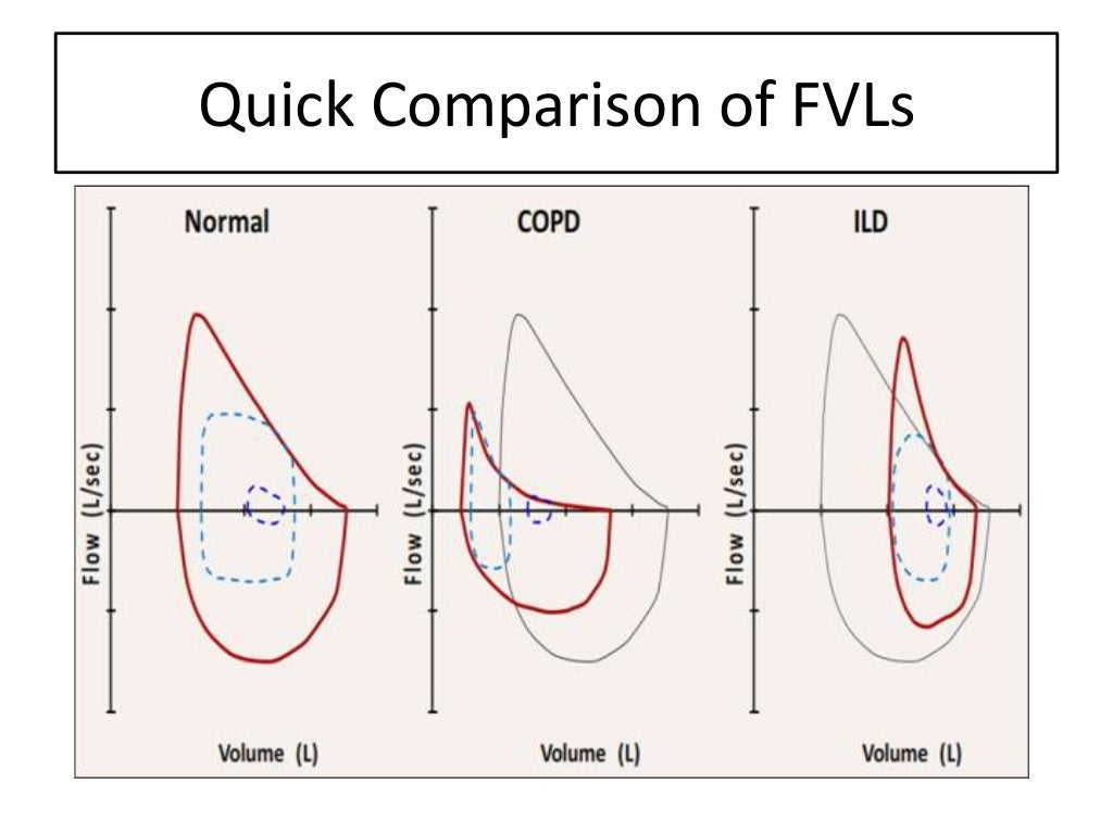 Role of flow volume loops in cpet