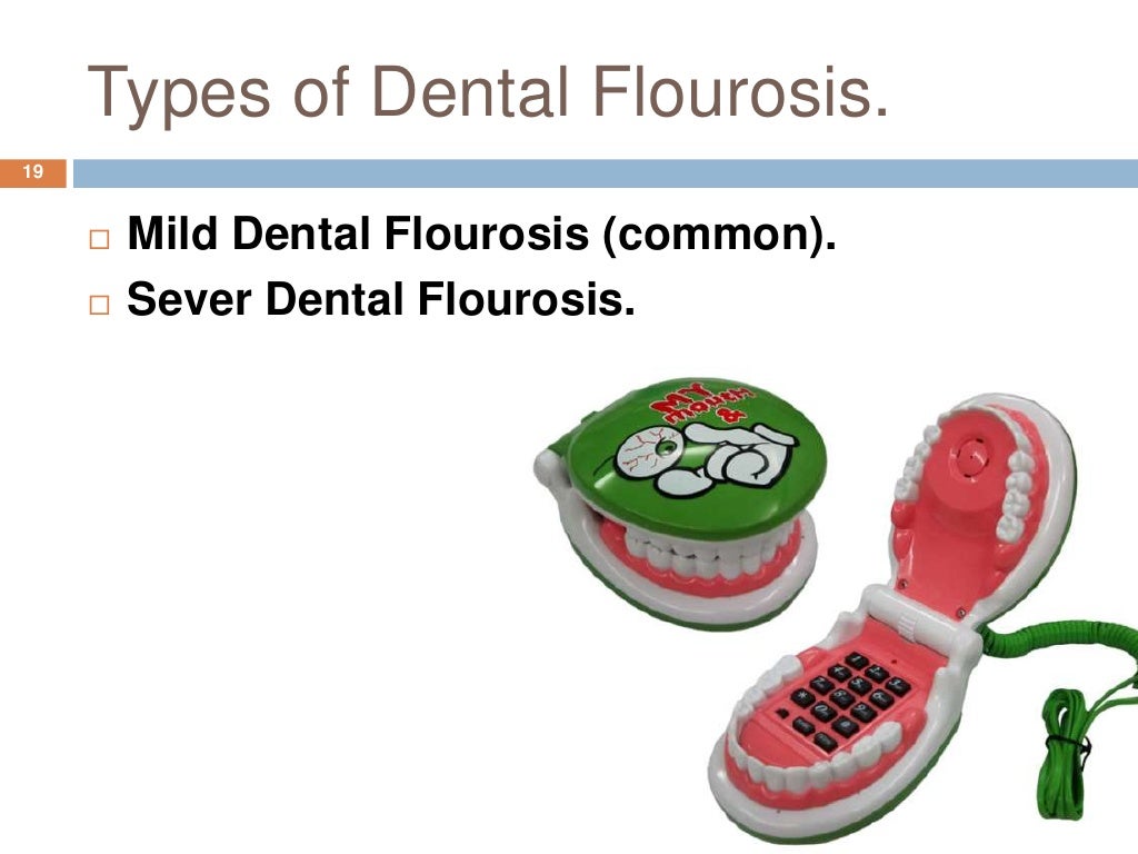Role of fluoride in dental health