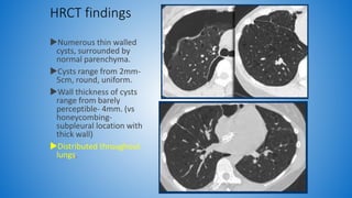 Role of hrct in interstitial lung diseases pk upload | PPTX