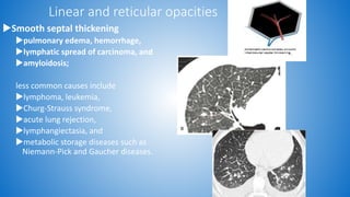 Role of hrct in interstitial lung diseases pk upload | PPTX