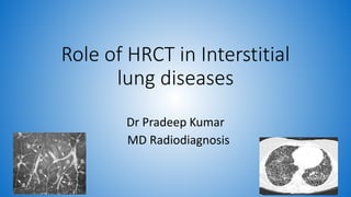 Role of HRCT in Interstitial
lung diseases
Dr Pradeep Kumar
MD Radiodiagnosis
 