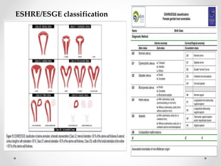 Eshre Rif Table Role of hysteroscopy in Recurrent Implanatation Failure | PPTX
