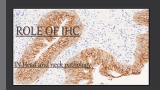 IN Head and neck pathology
ROLE OF IHC
 